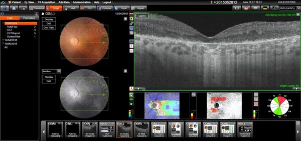 Photo of patient eye data